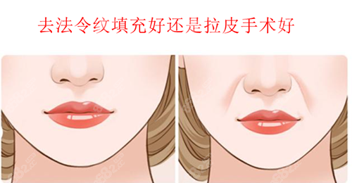 去法令纹填充好还是拉皮手术好