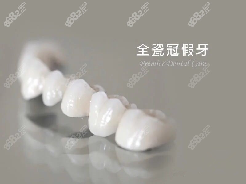 上海全瓷牙品牌及价格