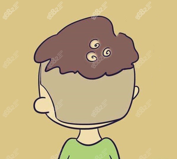 发旋可以通过植发进行矫正吗