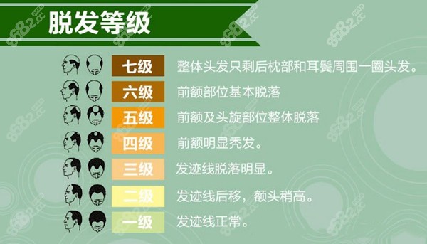 常见的1-7级脱发特征