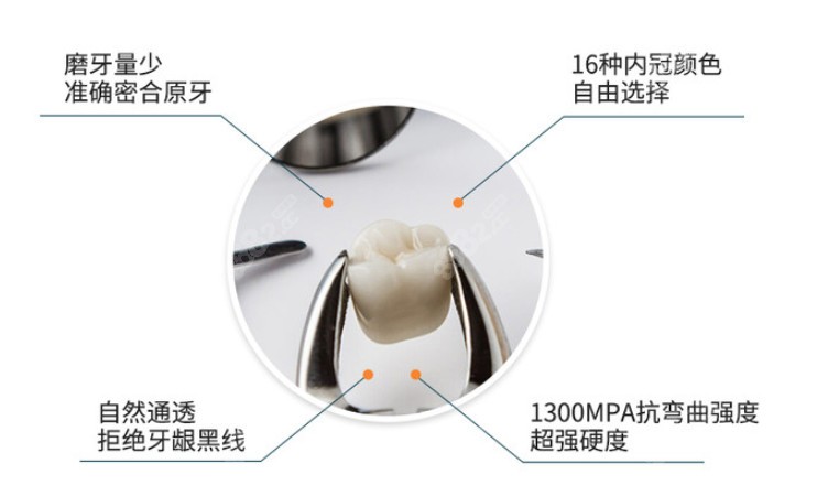 德国泽康全瓷牙冠所具备的优势