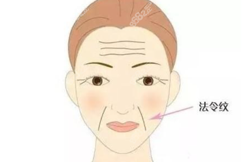 什么是法令纹