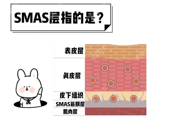 王志军高位smas筋膜层拉皮