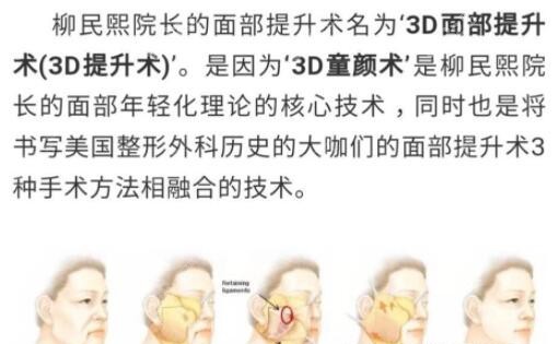 柳民熙3D童颜术