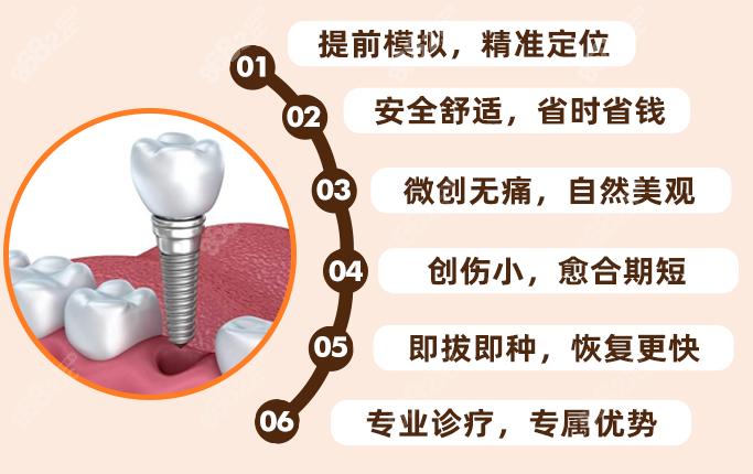 北极星连锁口腔种牙优势