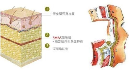 smas筋膜折叠和smas筋膜切除有什么区别