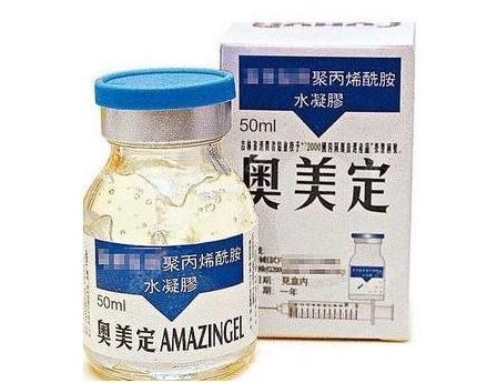 3d内窥镜取奥美定正规医院汇总,并告知下巴取奥美定的费用