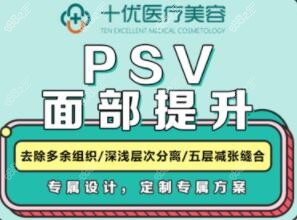 psv面部提升手术价格