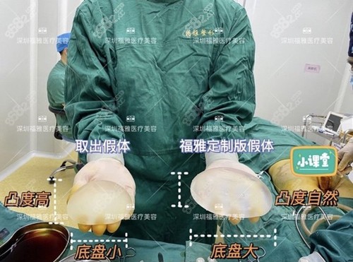 深圳福雅丰臀用的假体