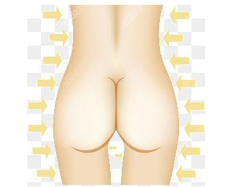 深圳假体丰臀哪家医院好呢？