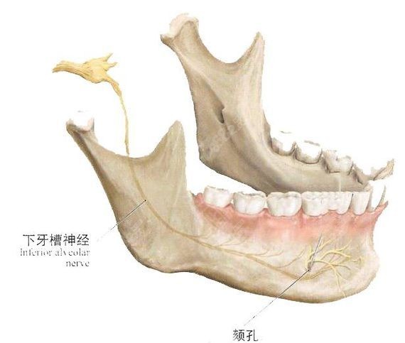 赵绛波做下颌角手术技术