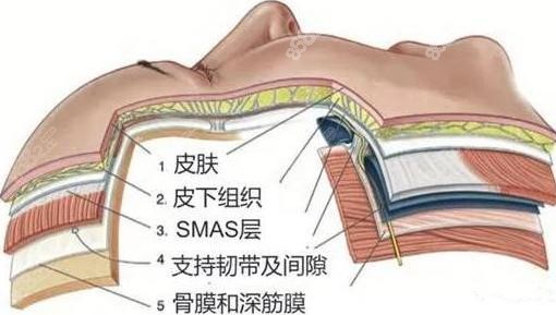 北京加减美做拉皮失败修复手术作用层次在肌肉下