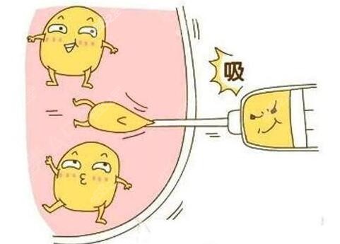 西安哪家医院吸脂做得好