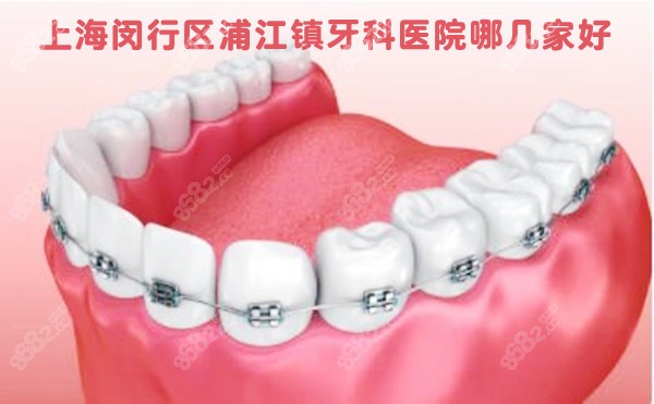 上海闵行区浦江镇牙科医院
