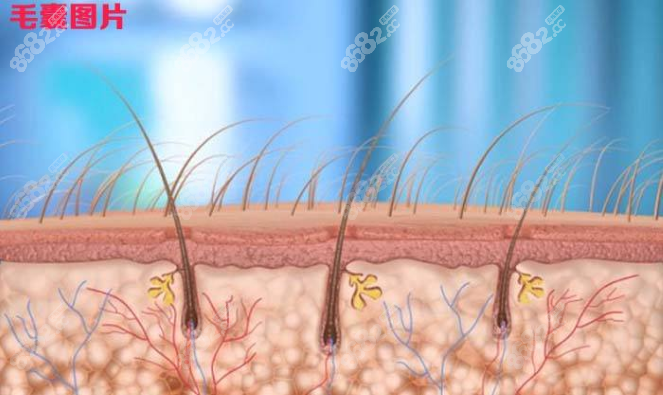 植发3000个毛囊图图片