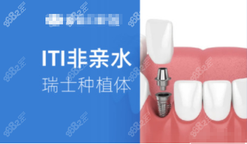 瑞士ITI非清水种植牙