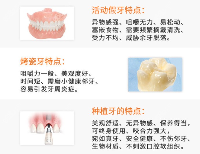 活动假牙、种植牙等优缺点对比