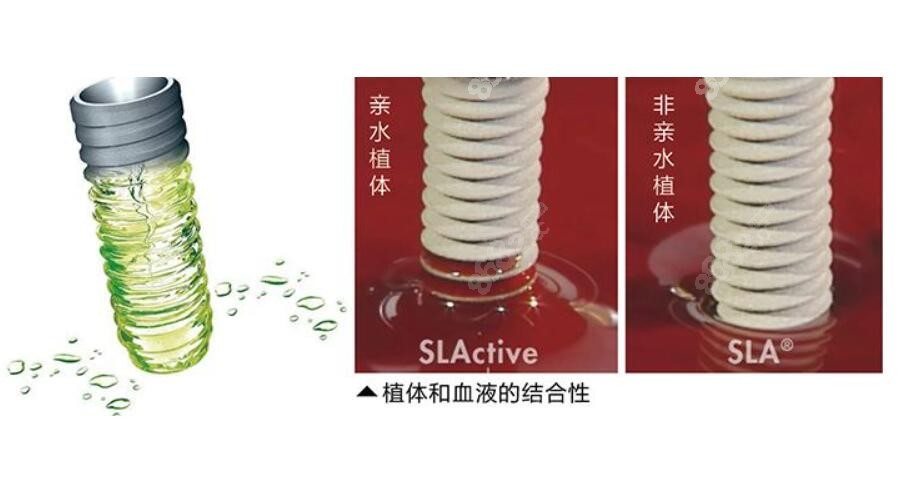 亲水种植体的特性