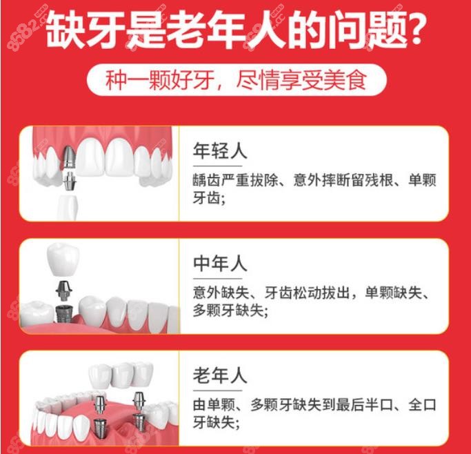 石岐种植牙比较好的医院介绍年轻人、中年人、老年人种牙的问题