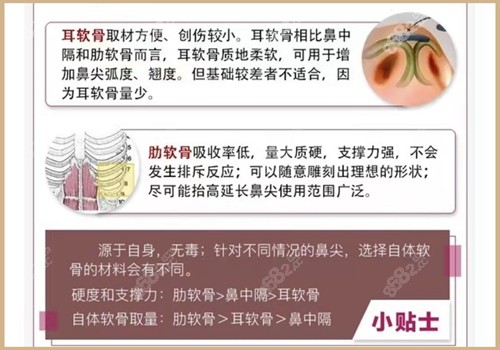 杭州艺星张龙隆鼻技术厉害