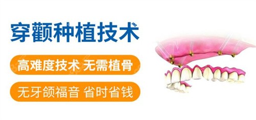广州穗华口腔穿颧穿翼技术