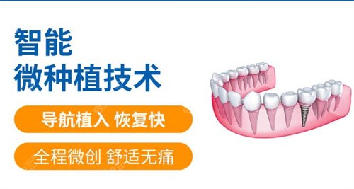 广州穗华口腔微创种植
