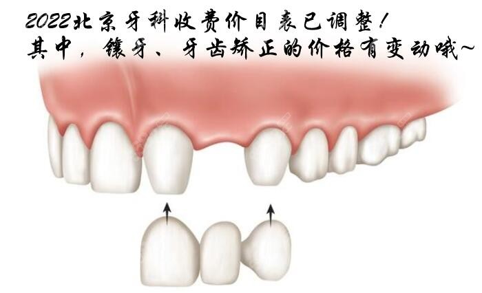 2022北京牙科收费价目表