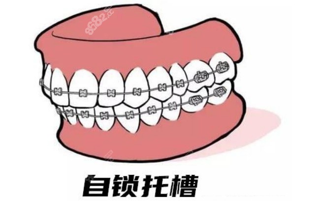 重庆江津区牙齿矫正多少钱