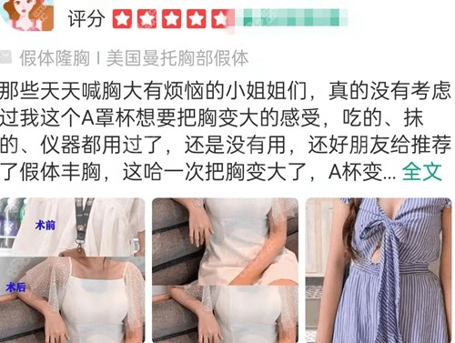 重庆美仑美奂整形隆胸怎么样？