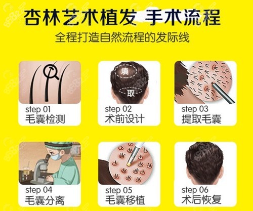 沈阳杏林植发科艺术植发手术过程
