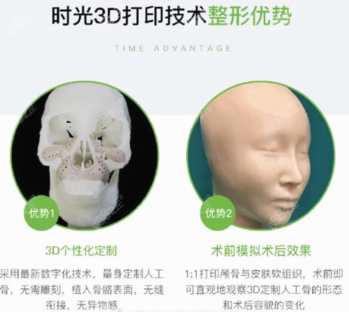 杭州时光3d打印人工骨修复下颌角技术介绍