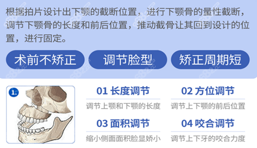 广大医院正颌优势