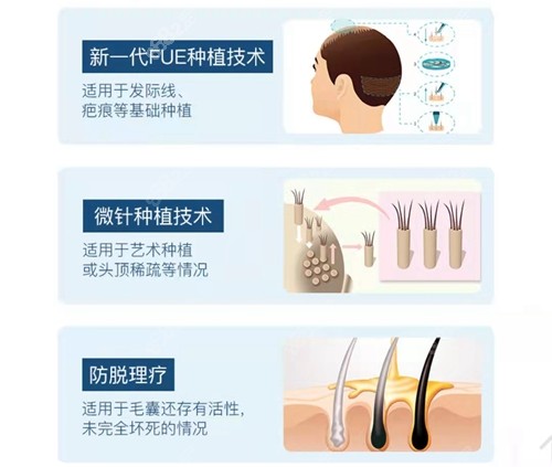成都丝恒植发技术好