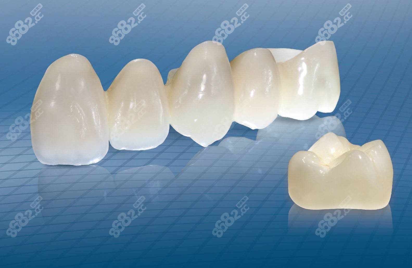 全瓷牙镶牙过程-爱康健齿科