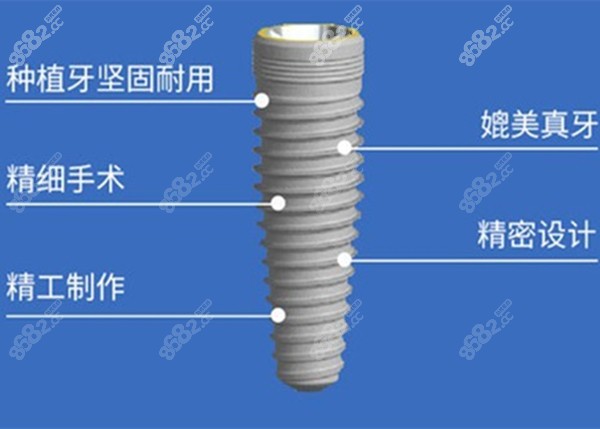 种植体的优势图