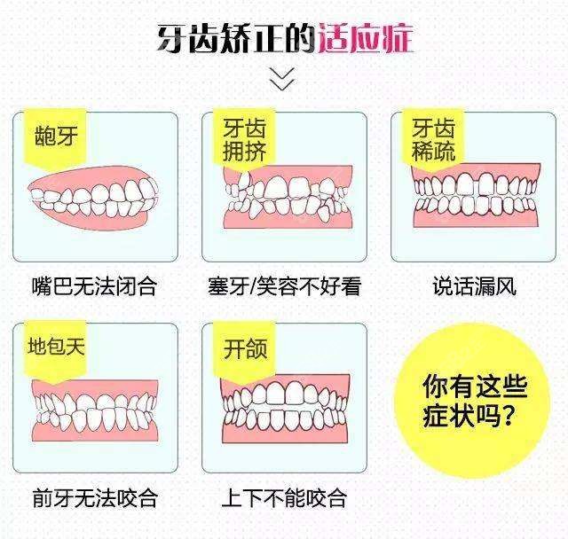 东艺口腔做种植牙和牙齿矫正都挺好