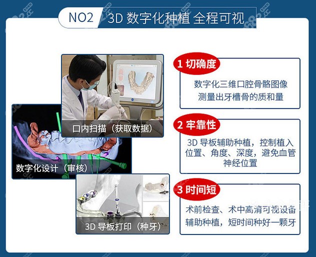 3D数字化种植牙的优点