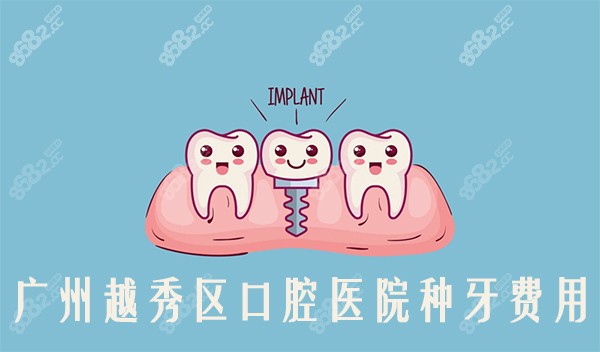 广州越秀区口腔医院种牙费用