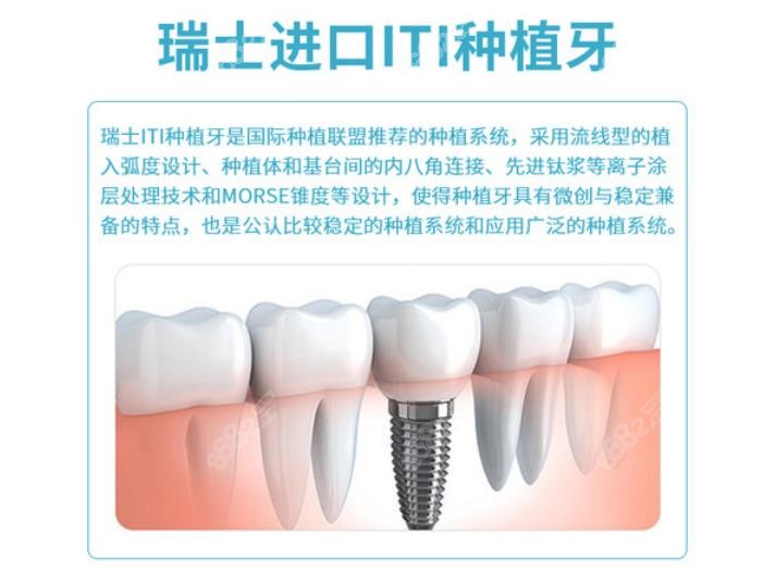 进口的瑞士ITI种植体优势