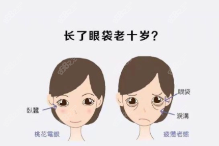 健丽去眼袋怎么样呢？