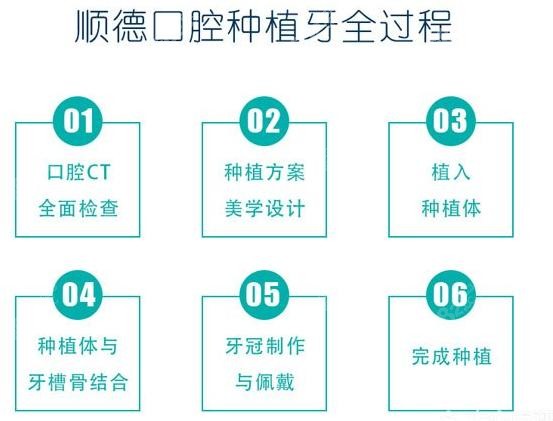 <!--<i data=20240705-sp></i>-->口腔种植牙流程正规