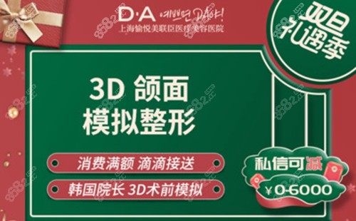 上海美联臣整形医院做磨骨手术术前3D数字化模拟