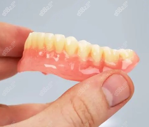 假牙应该怎么选