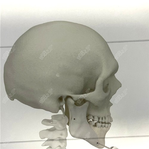 头骨模型图