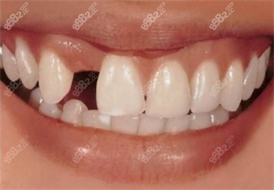 2022湖南<!--<i data=20240705-sp></i>-->口腔收費(fèi)標(biāo)準(zhǔn)2.jpg