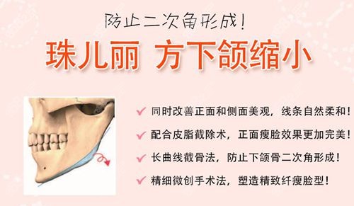 韩国珠儿丽下颌角手术优势