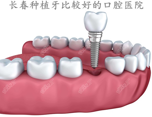 长春做种植牙比较好的口腔医院排名
