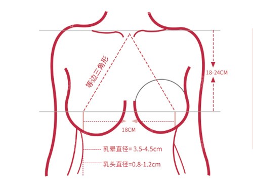 深圳曹孟君隆胸设计