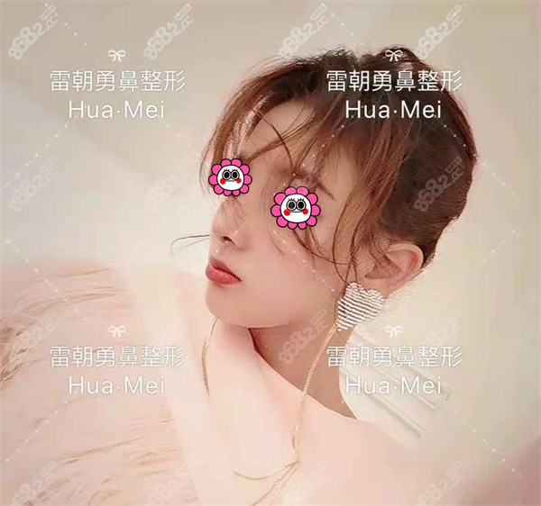 实例1