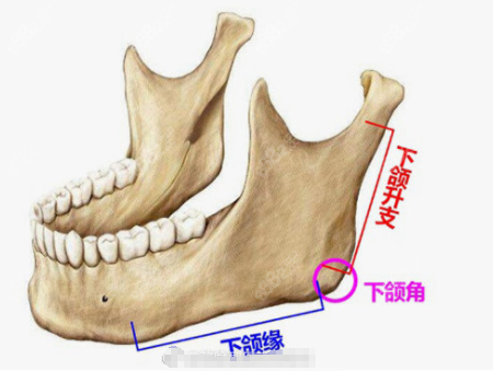 国字脸磨骨手术